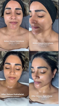 Images Skincare by Rosie