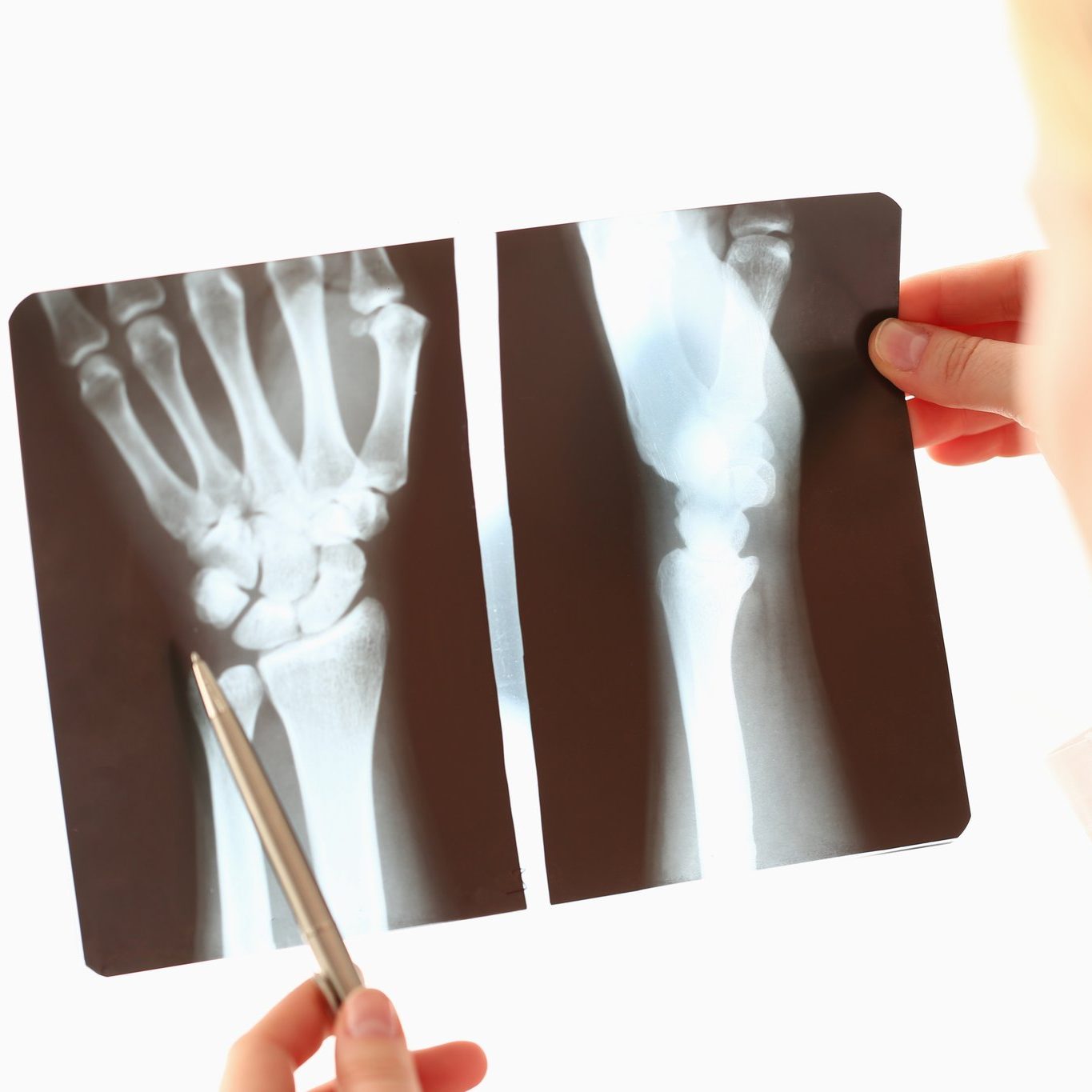 Images Physio Élite - Physiothérapeute Saint-Jérôme