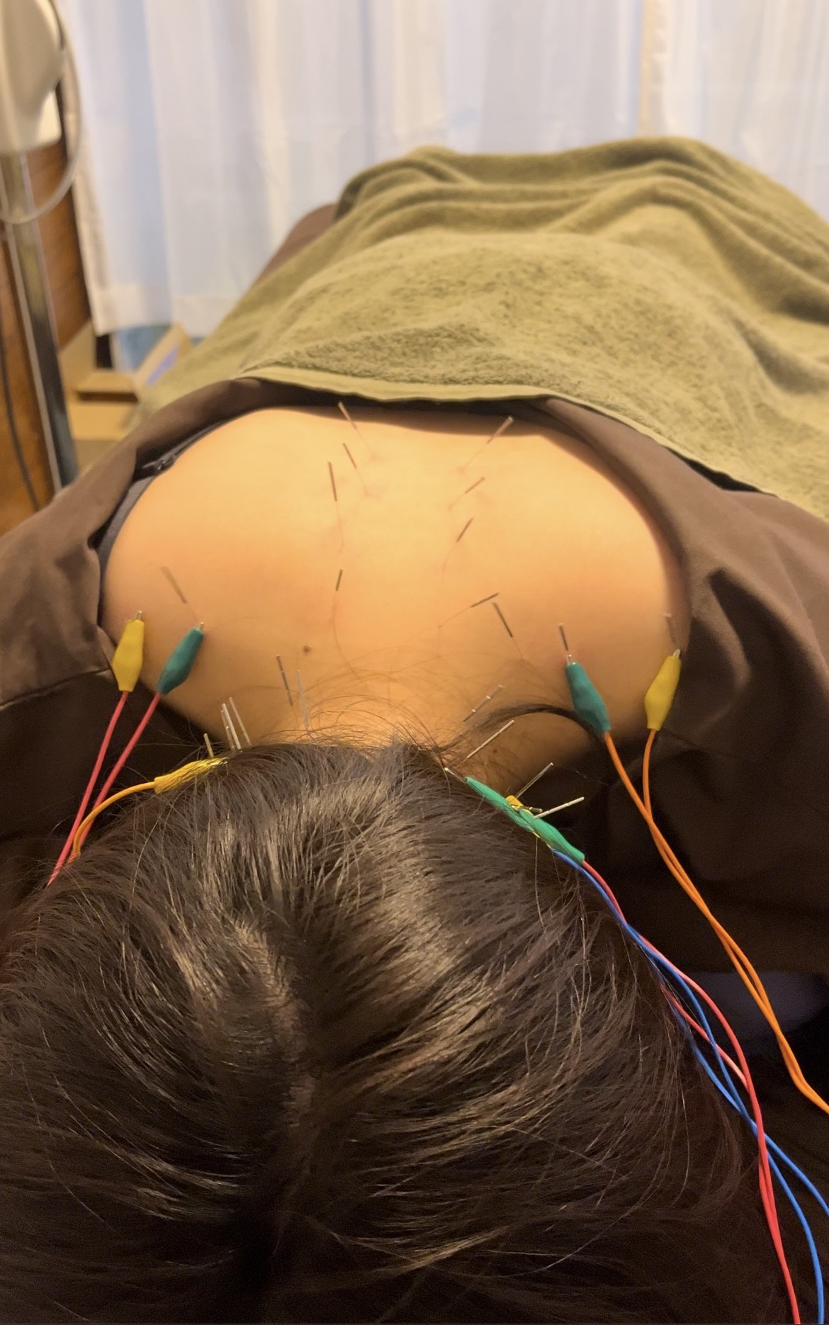 Images 鍼処MINAOSHI