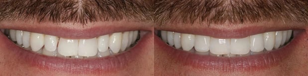 Images Iroquois Dentistry