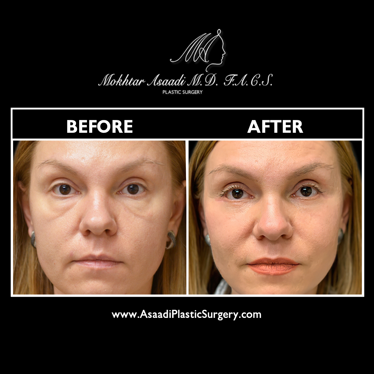 Asaadi Plastic Surgery Image