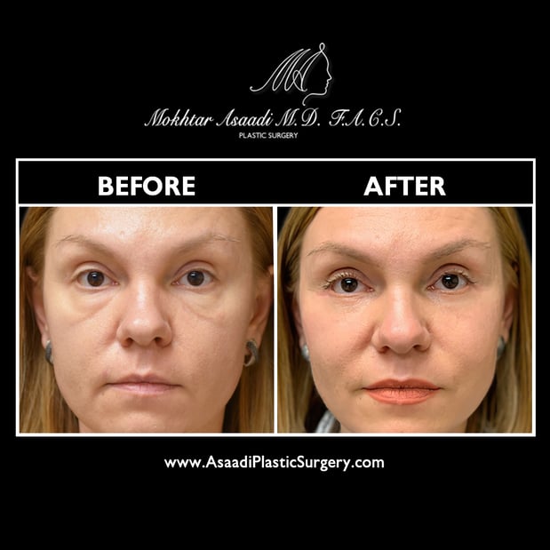 Images Asaadi Plastic Surgery