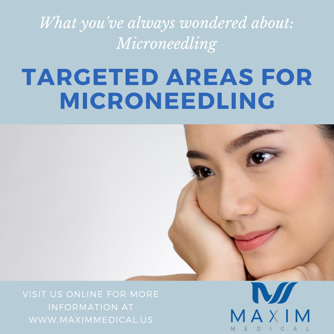 3. Targeted Areas For Microneedling
 
Microneedling is most often used on your face to target:
Acne Scars
Age Spots (also called “Sun Spots”)
Fine Lines and Wrinkles
Large Pores
Other Types of Scars
Reduced Skin Elasticity
Uneven Skin Tone
 
In addition to facial concerns, microneedling is sometimes used to treat stretch marks in other areas of the body.