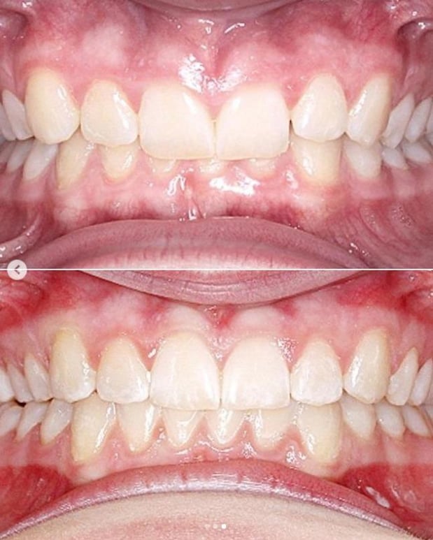 Images Burlingame Smile Studio Orthodontist April Lee DDS MS