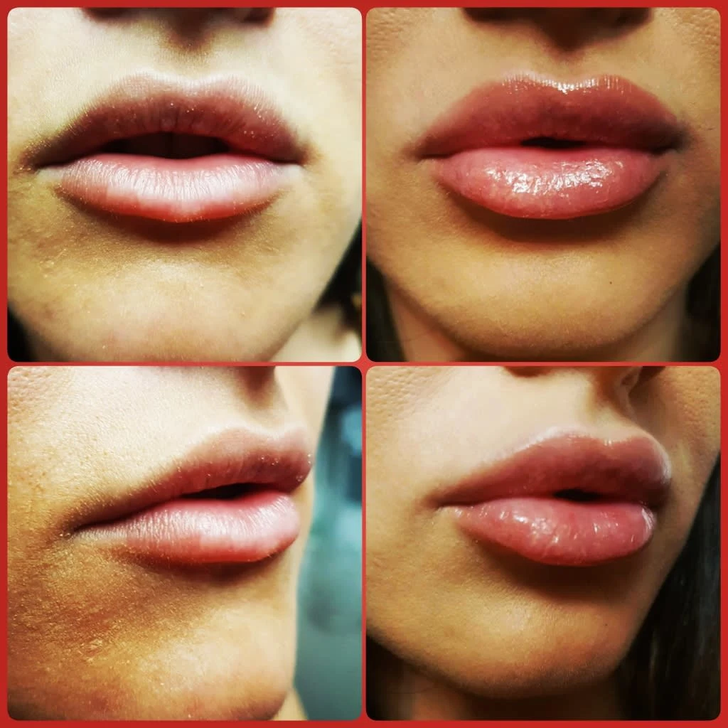 Images Lincoln Aesthetic