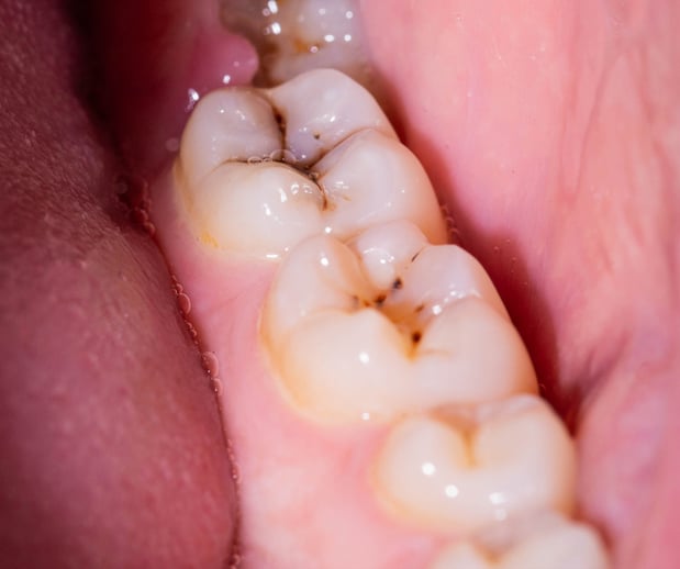 Images Silver State Dental
