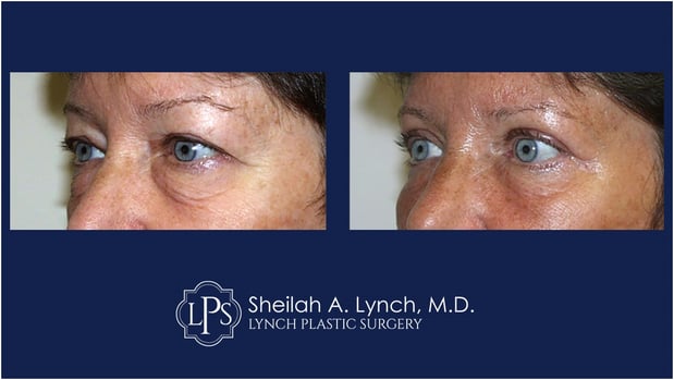 Images Dr. Sheilah A. Lynch