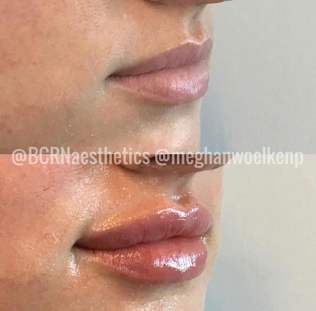 Images BCRN Aesthetics MedSpa