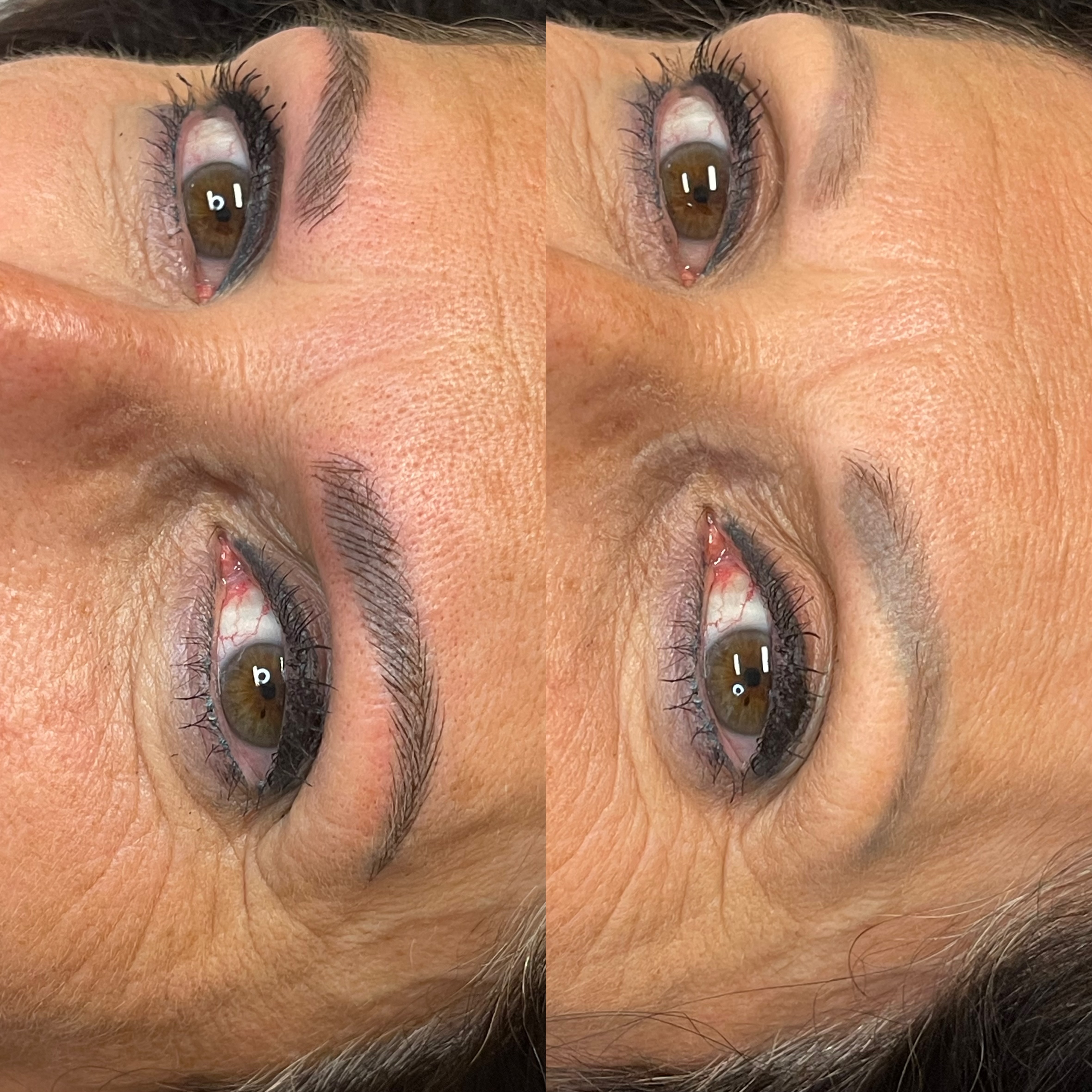 Images Clinique d'Esthétique Leila - Hydrafacial, Microblading, Épilation Laser Sainte-Foy