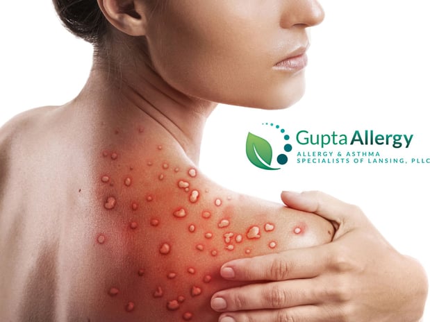 Images Gupta Allergy: Allergy & Asthma Specialists of Lansing, PLLC