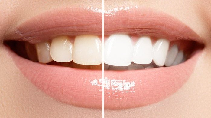 Images Clinique Dentaire Dr. Karam - Dentiste, Blanchiment Dentaire Ahuntsic