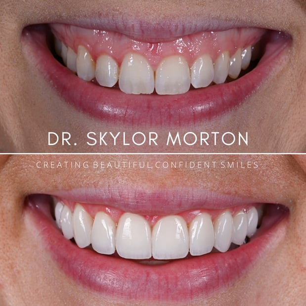 Images Nashville Wisdom Teeth and Implant Solutions