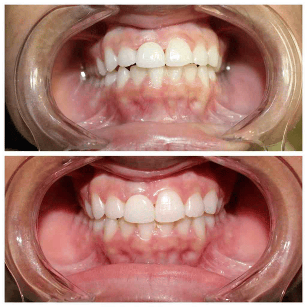 Images Summer Creek Dental