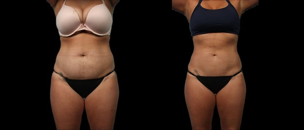 Images Marietta Plastic Surgery