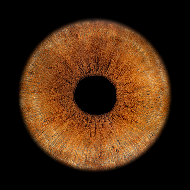 Bilder Müller Optik AG