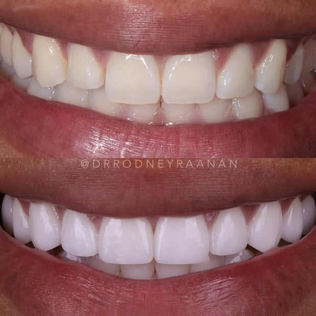 Images Dr. Rodney Raanan