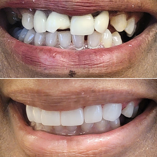 Images Advanced Dentistry & Implant Center