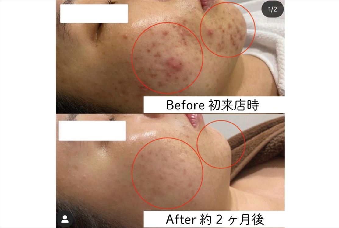 Images 肌質改善サロンサルヴァトーレ長崎