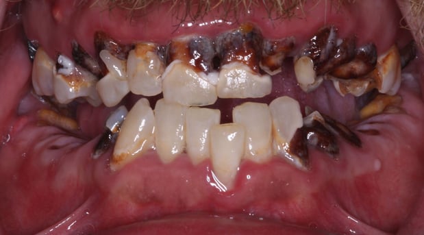 Images SmileCare Dental