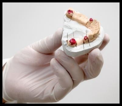 Images Studio Dentistico Strijbosch del Dr. Jacobus Strijbosch