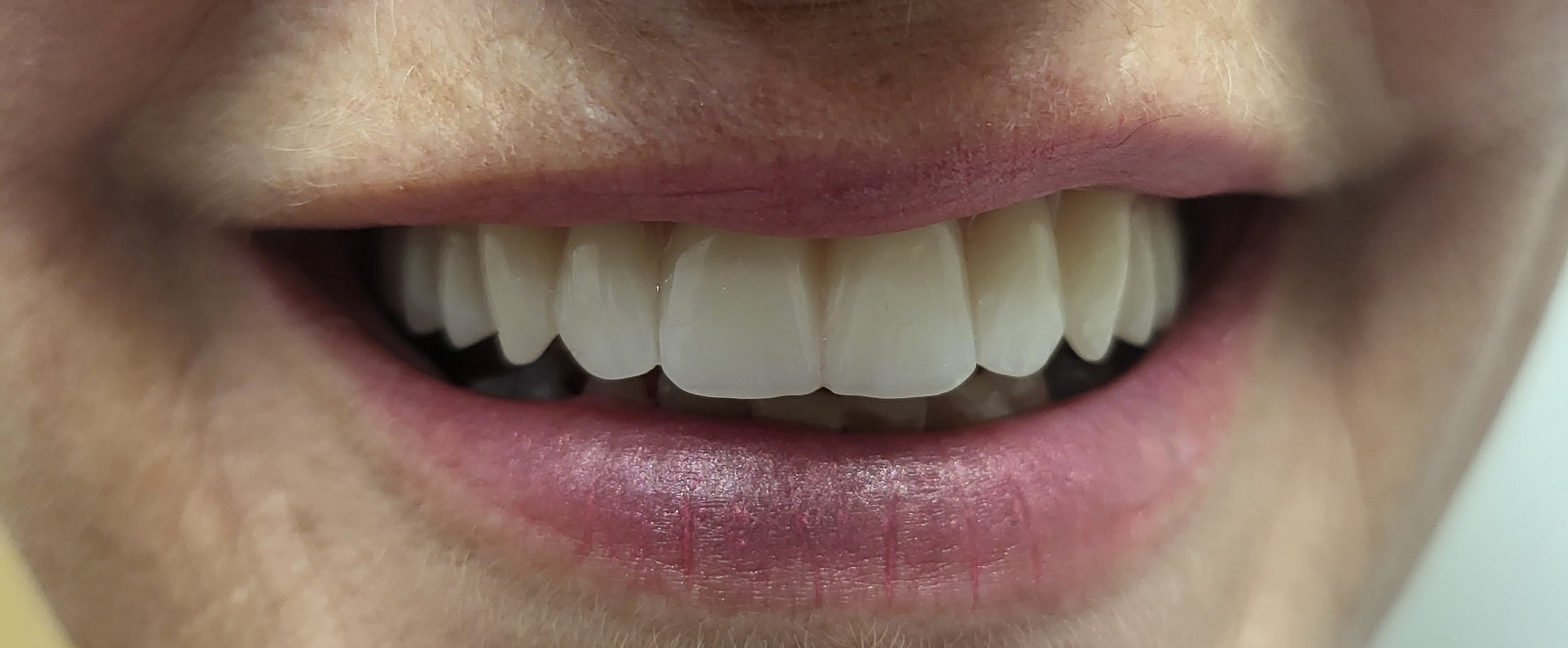 Images Damon Denture Designs Pty Ltd