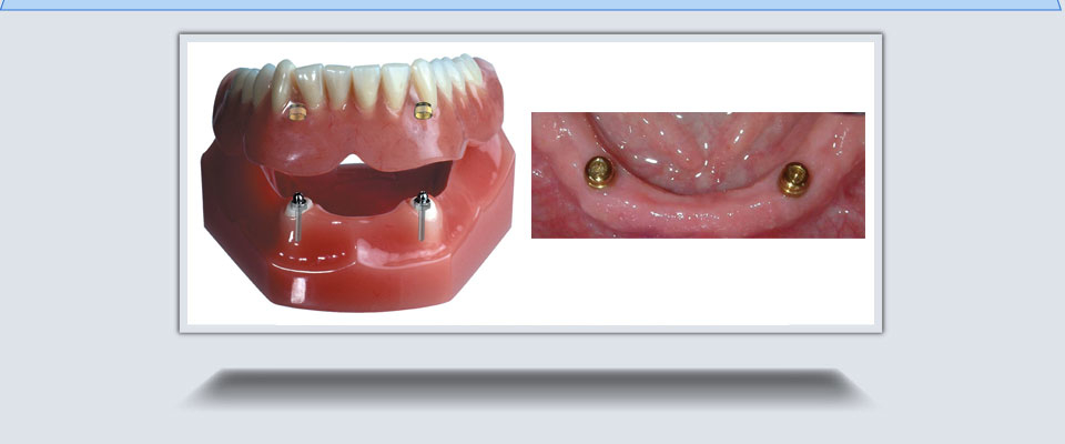 Images Waterdown Denture Clinic