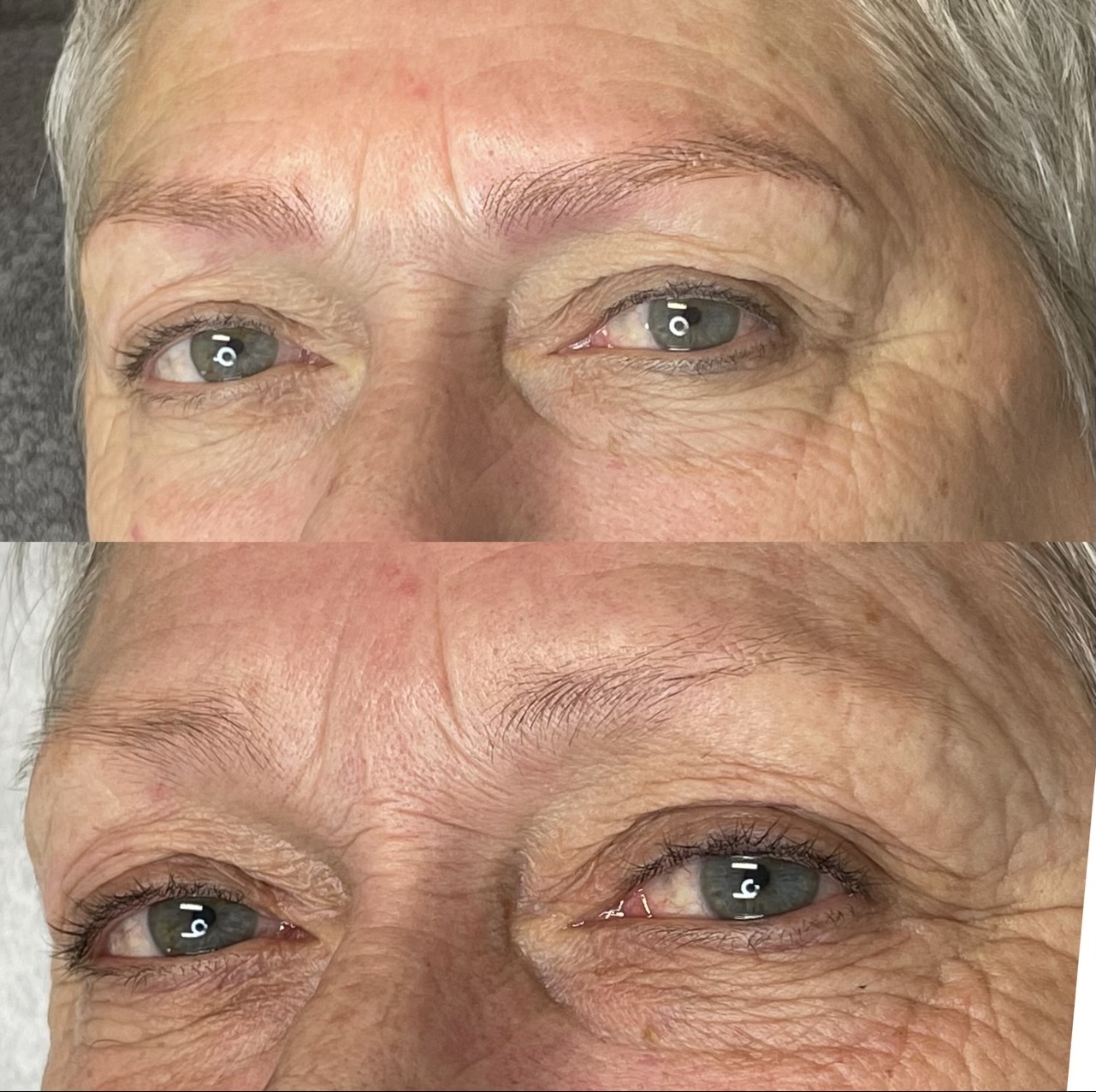 Images Clinique d'Esthétique Leila - Hydrafacial, Microblading, Épilation Laser Sainte-Foy