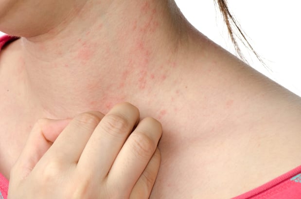 Images Gupta Allergy: Allergy & Asthma Specialists of Lansing, PLLC
