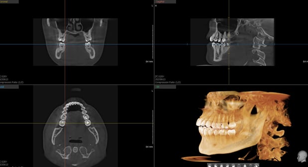 Images Mt. Pleasant Modern Dentistry