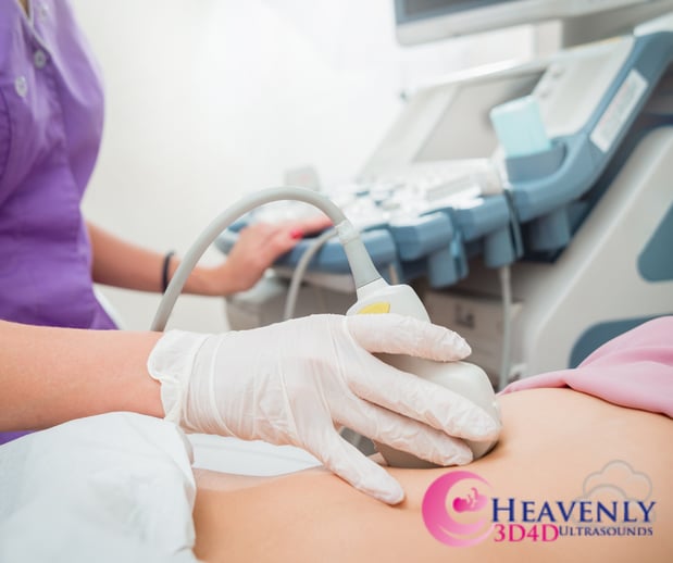 Images Heavenly 3D 4D Ultrasounds
