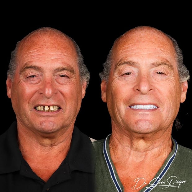 Images Smile Now Denver Dentures and Implants