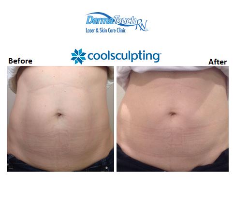 Images DermaTouch RN