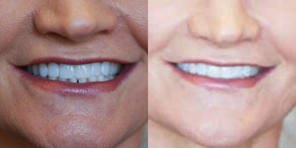 Images Haws Family Dentistry