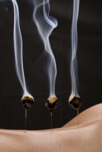 Traditionellen Chinesischen Medizin Praxis Hildegard Kunz, Sonnhaldenstrasse 3 in Uster