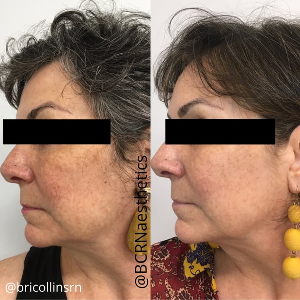 Images BCRN Aesthetics MedSpa