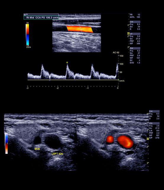 Bilder Echographie à domicile et en EMS, IRM ouverte, Scanner, Mammographie Dr Lacrosniere