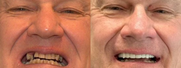 Images Riverside Family Dental