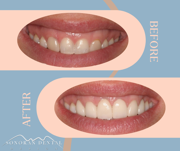 Images Sonoran Dental Design