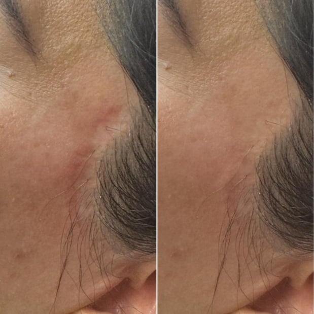 Images Permaskin Beauty Center & Academy