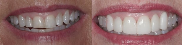 Images Watters Creek Dental