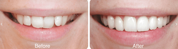 Images Northpointe Smiles