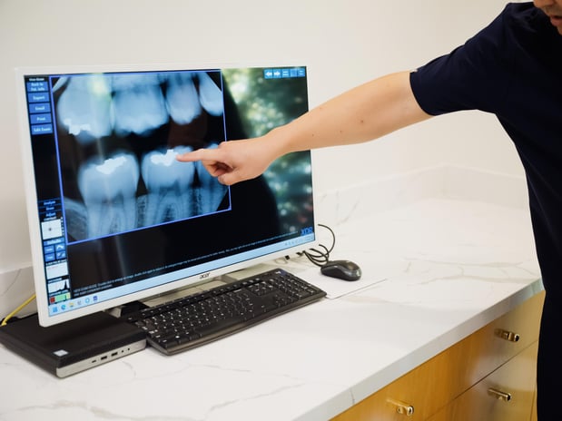 Images Sugarfree Dental
