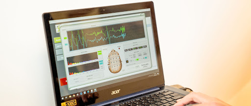 Images NeuroLogic