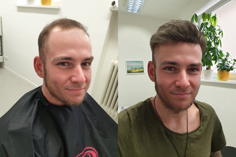 Top Secret Hair Design Munich Zweithaarstudio, Nietzschestraße 17 in München