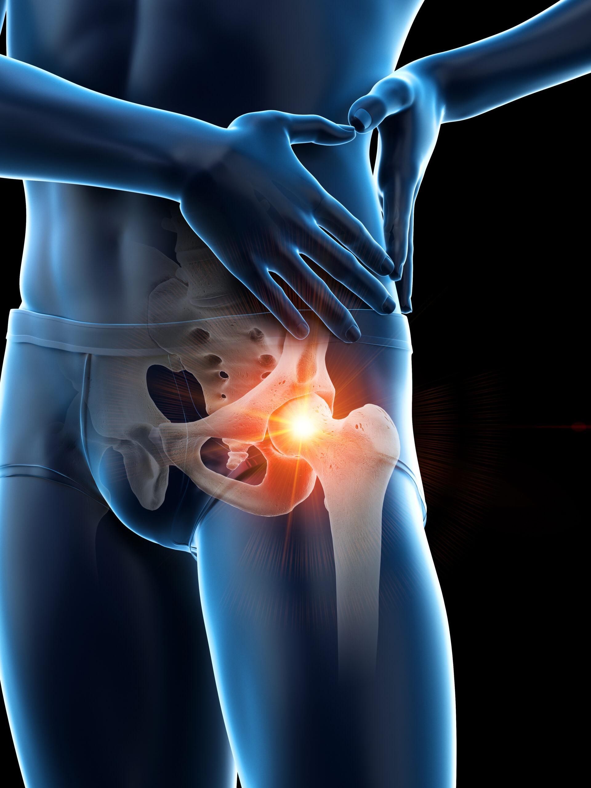 Images FIXBONES - Mr Arshad Barmare - Melbourne Specialist and Orthopaedic Centre