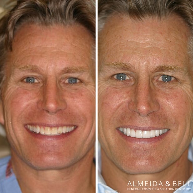 Images Almeida & Bell Dental Lone Tree - General, Cosmetic, and Implant Dentistry