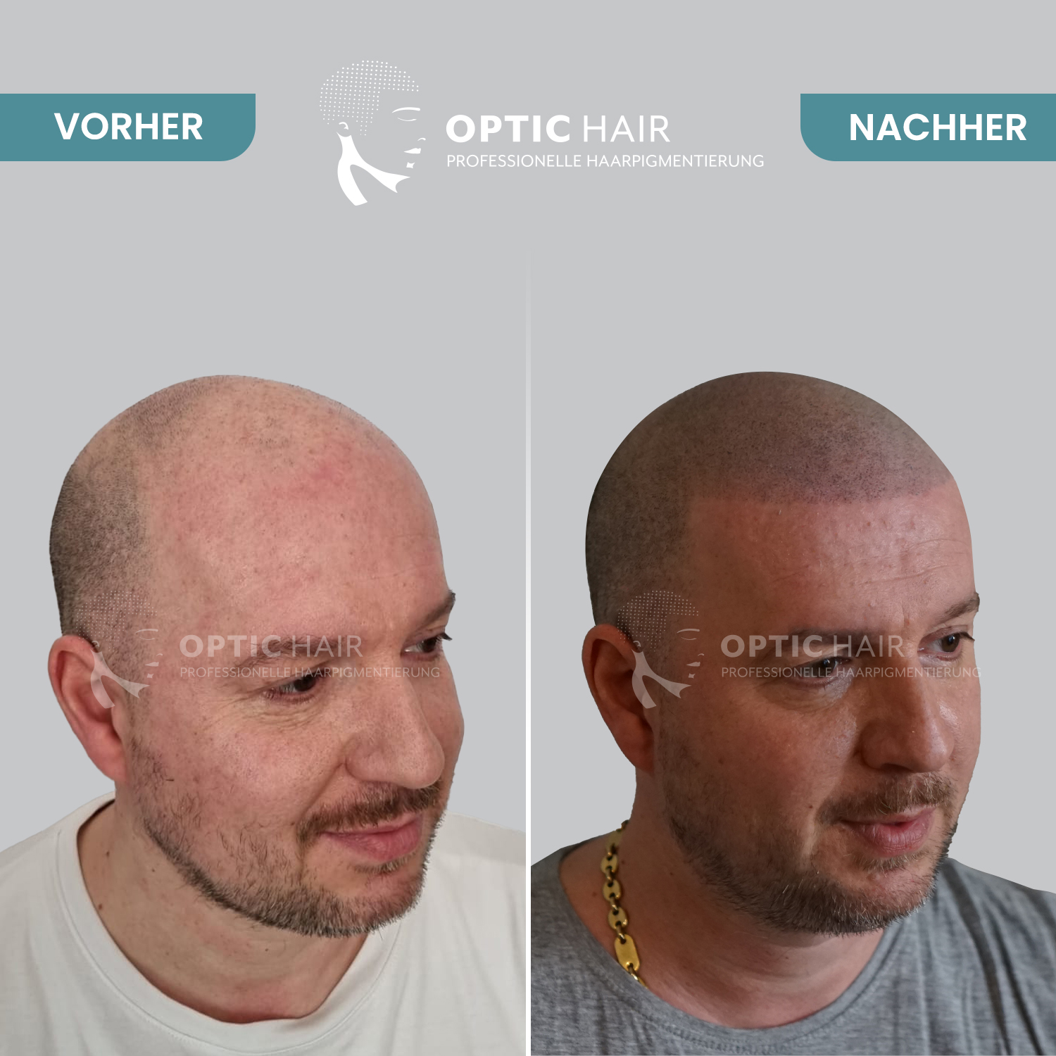 Haarpigmentierung Berlin | OpticHair, Silvio-Meier-Straße 2 in Berlin