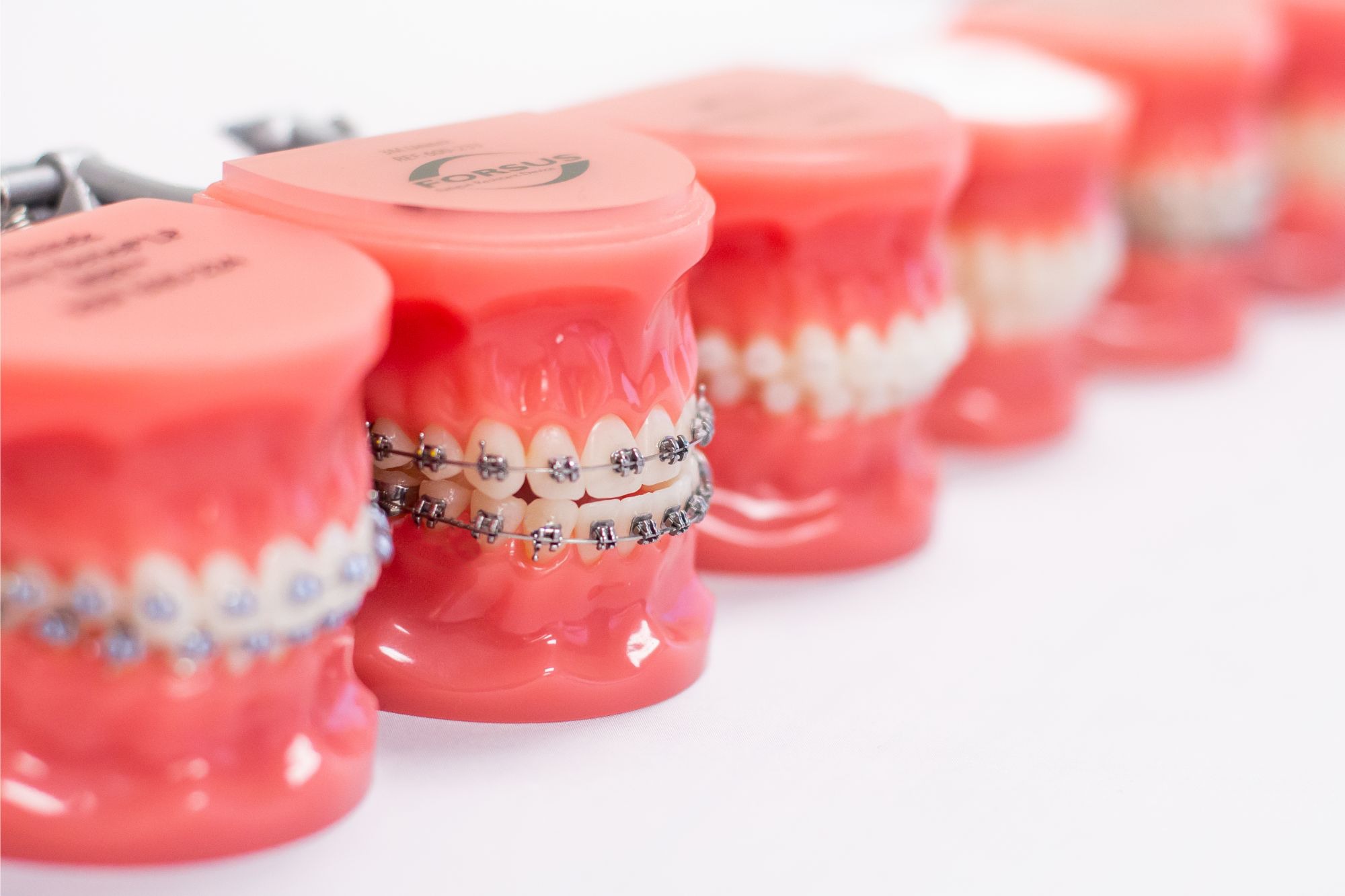 Learn about the science behind a beautiful smile with our orthodontic models at Imagine Orthodontics.