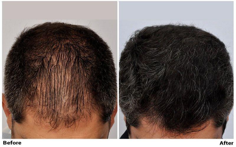 Images ForHair NYC Restoration Clinic - Dr. John Cole