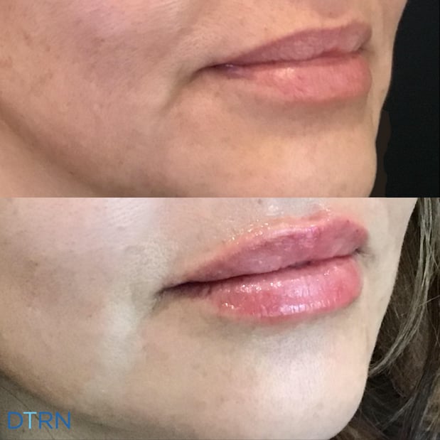 Images DermaTouch RN